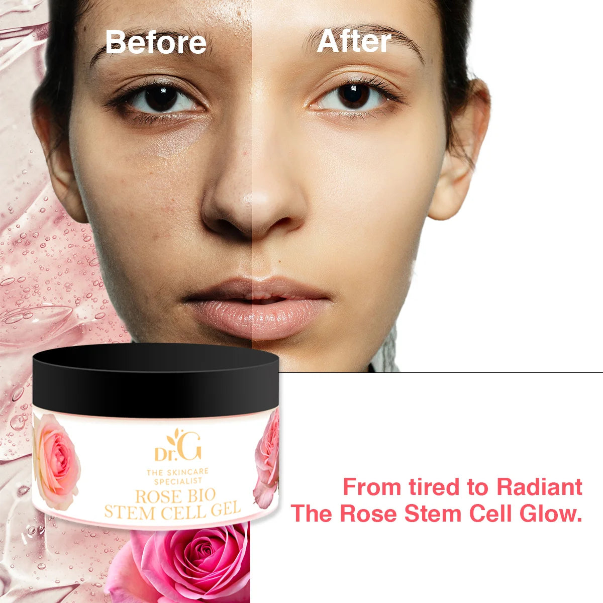 Skinby Dr.G Rose Bio Stem Cell Gel | Hydrating & Revitalizing Gel with Rose Stem Cells